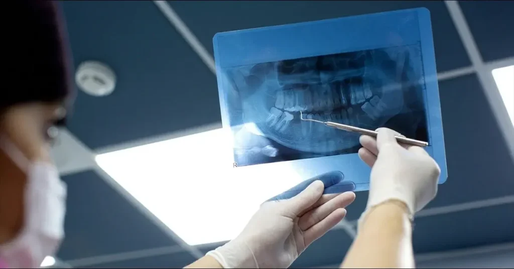 What to Do If You Break Your Tooth