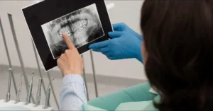 What to Do If You Break Your Tooth