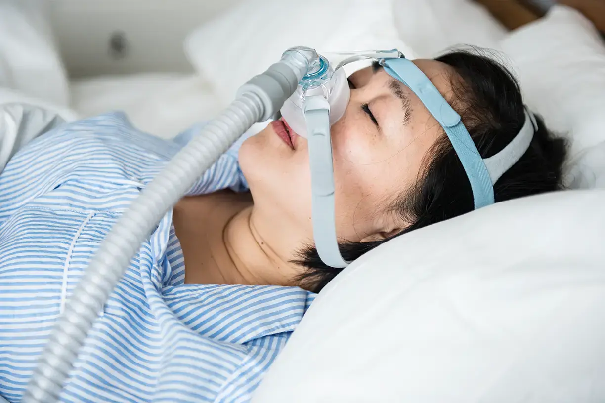 A woman sleeping in bed wearing a CPAP mask and headgear for sleep apnea treatment, with the hose connected to the nasal mask.